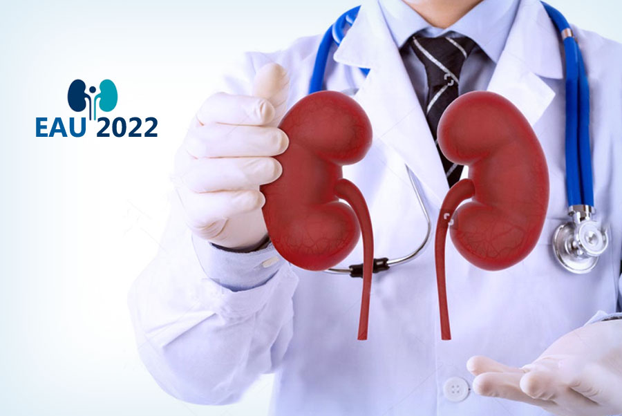 Affluent Medical participera au Congrès EAU 2022 (European Association of Urology Congress)