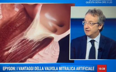 Interview with Pr Mauro Rinaldi, Head of Cardiac Surgery (in Italian)
