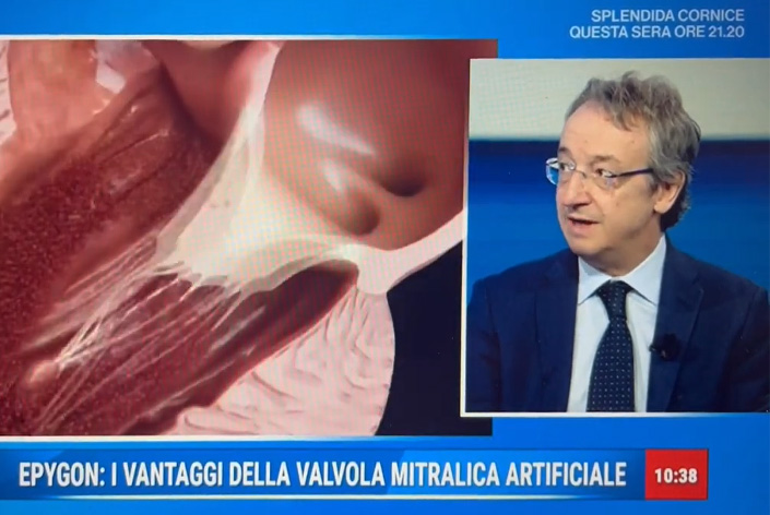Interview du Pr Mauro Rinaldi, Chef de service en Chirurgie cardiaque (en italien)