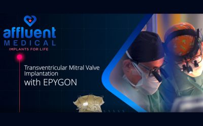 Epygon mitral heart valve implantation in a first patient
