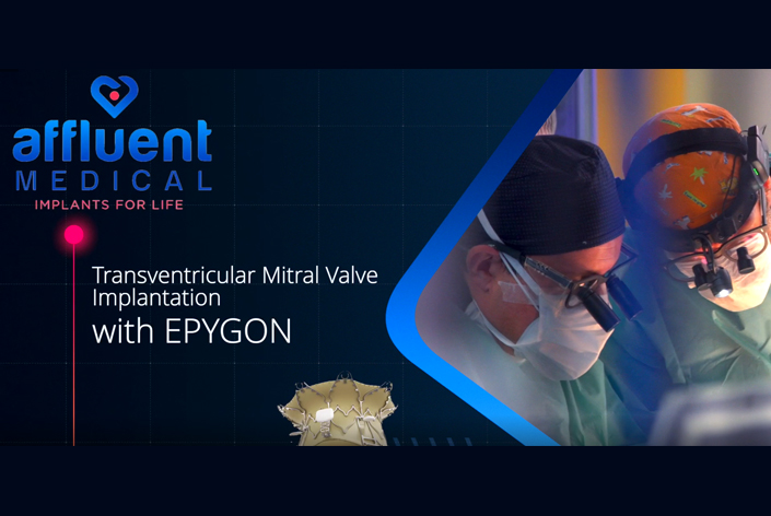 Epygon mitral heart valve implantation in a first patient