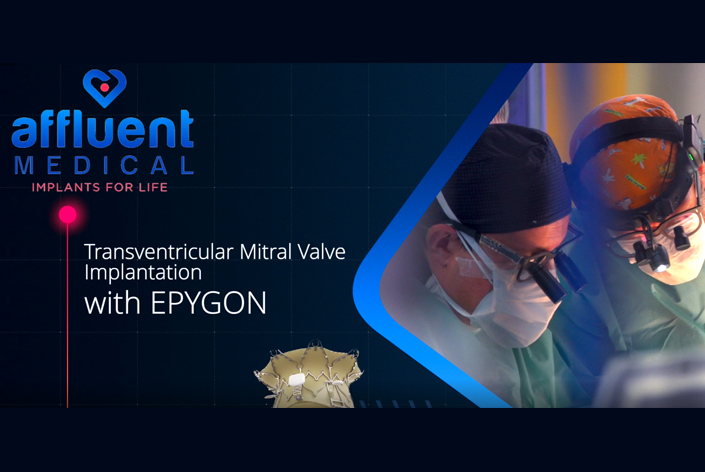 Implantation de la valve cardiaque mitrale Epygon sur une première patiente (en anglais)